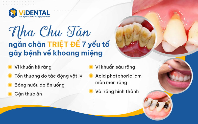 Nha Chu Tán ngăn ngừa 7 yếu tố gây bệnh răng miệng