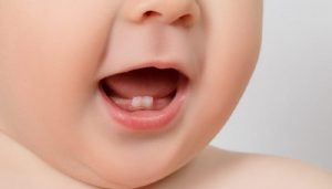 Lý do vì sao trẻ chậm mọc răng và cách đối phó