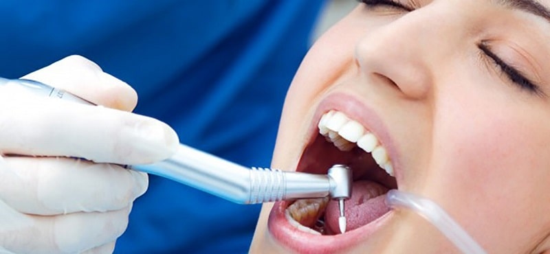Bạn nên chọn nha khoa uy tín để tránh tình trạng ê buốt sau khi lấy cao răng