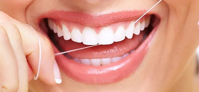 Bạn nên sử dụng chỉ nha khoa để nhẹ nhàng lấy đi mảng bám trong kẽ răng