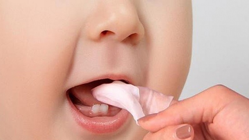 Điều trị nấm miệng ở trẻ sơ sinh bằng thuốc Tây