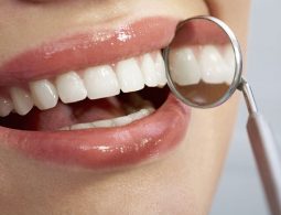 Bọc răng Composite là gì? Có nên thực hiện hay không?