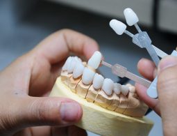Bọc răng sứ Cercon là gì? Ưu và nhược điểm ra sao? 