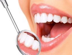 Bọc răng sứ nguyên hàm: Lợi ích, chi phí và quy trình thực hiện