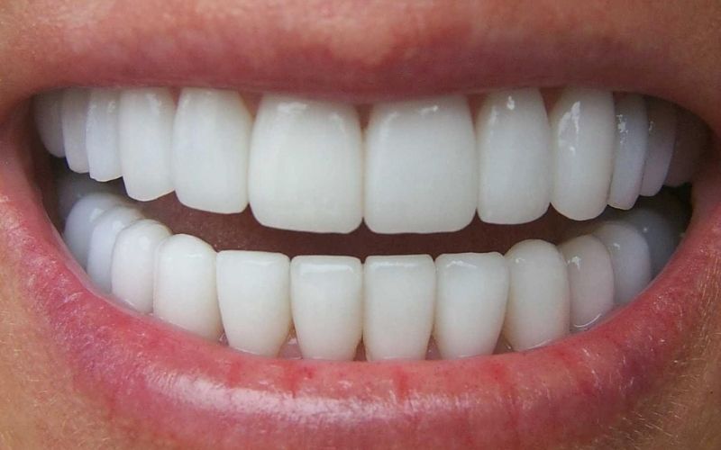 Bọc sứ răng cửa là phương pháp giúp khôi phục khả năng ăn nhai, tăng tính thẩm mỹ