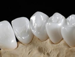 Zirconia là loại răng sứ đặc biệt, đảm bảo an toàn tuyệt đối cho sức khỏe răng miệng