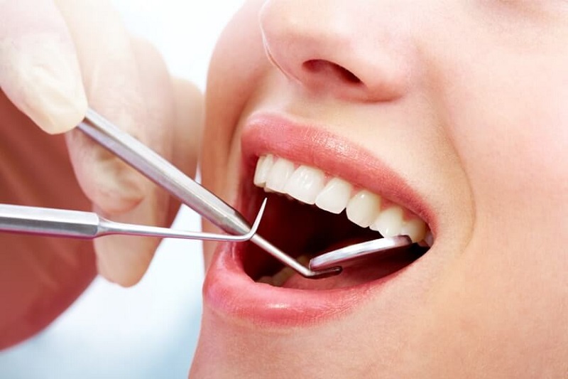 Khi lấy cao răng bạn cần tuân theo chỉ định từ bác sĩ để đảm bảo an toàn tối đa