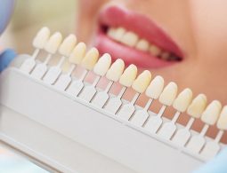 Bọc răng sứ có hại không là thắc mắc của không ít người có nhu cầu.