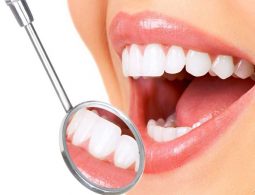 Bọc răng sứ giúp bạn sở hữu hàm răng đều đẹp chỉ ngay từ lần điều trị đầu tiên