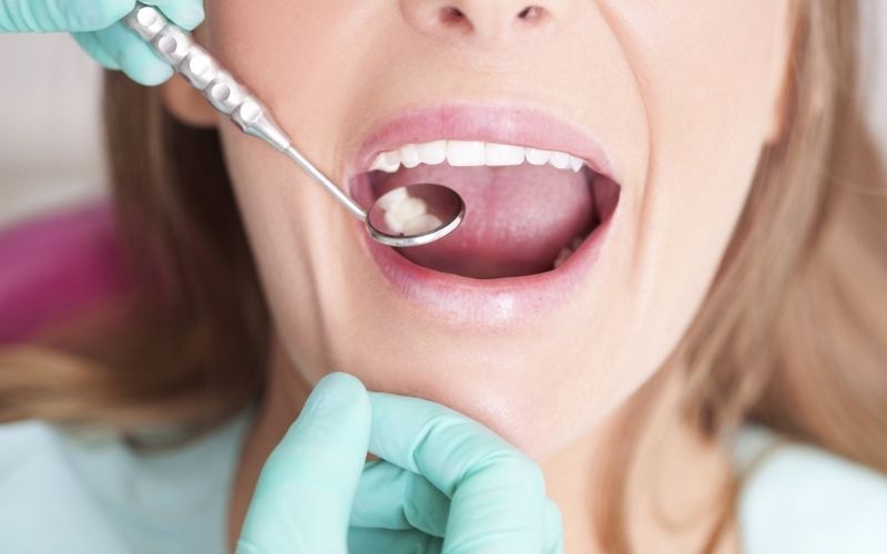 Tuổi thọ sử dụng của răng phụ thuộc vào tình trạng răng miệng hiện tại