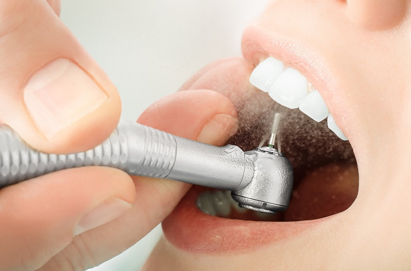 Mài răng bọc sứ phải được thực hiện bởi những bác sĩ có chuyên môn cao