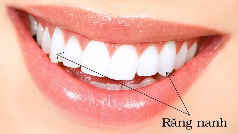Răng nanh là chiếc răng ở vị trí thứ 3 trên hàm răng