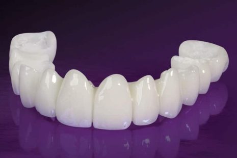 Trồng răng sứ là biện pháp phục hình răng miệng được nhiều người sử dụng