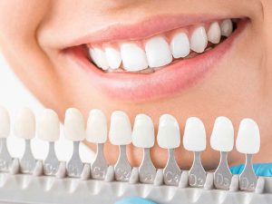 Bọc răng sứ cải thiện một số khuyết điểm về răng và nâng cao tính thẩm mỹ
