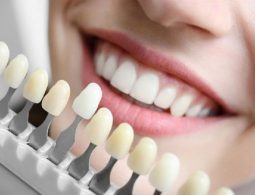 Bọc răng sứ titan có tốt không, nên thực hiện ở đâu hiệu quả?