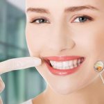 Răng cửa: Đặc điểm và phương pháp làm đẹp răng hiệu quả