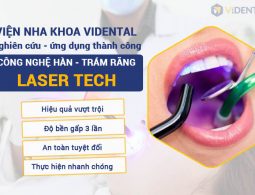 ViDental nghiên cứu công nghệ hàn trám răng Laser Tech