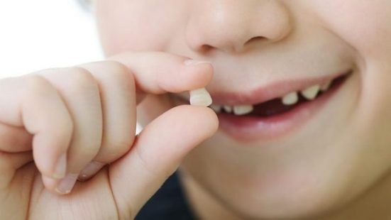 Nhổ răng sữa mọc lệch: Khi nào nên thực hiện và gợi ý địa chỉ điều trị tốt nhất?