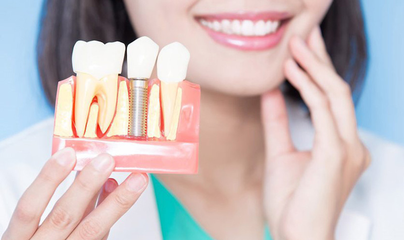 Răng implant có cấu tạo như răng thật nên đáp ứng tốt việc ăn nhai