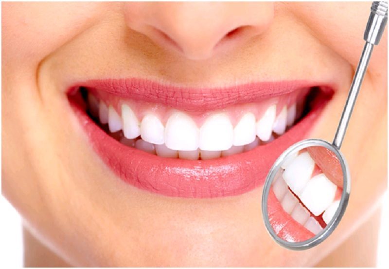 Mỗi loại răng sứ đều có những ưu điểm nhất định
