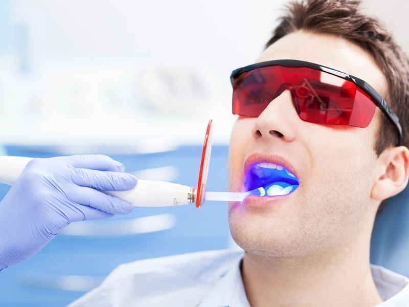 Laser Whitening là phương pháp làm trắng răng hiệu quả cao