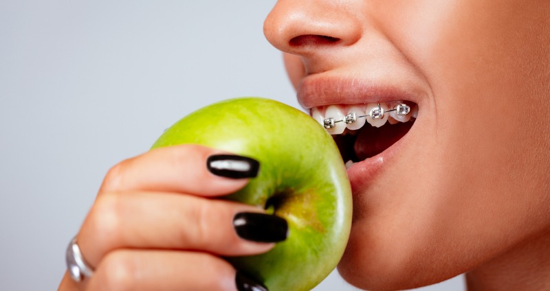 Chế độ dinh dưỡng rất quan trọng đối với người niềng răng