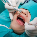 Trồng Răng Implant Ở Đâu Tốt Và Những Tiêu Chí Đánh Giá?