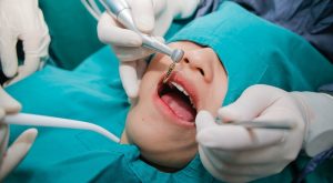 Trồng Răng Implant Ở Đâu Tốt Và Những Tiêu Chí Đánh Giá?