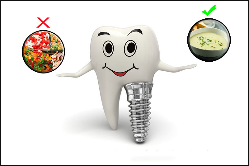 Cần cân nhắc chế độ ăn hợp lý khi vừa trồng răng