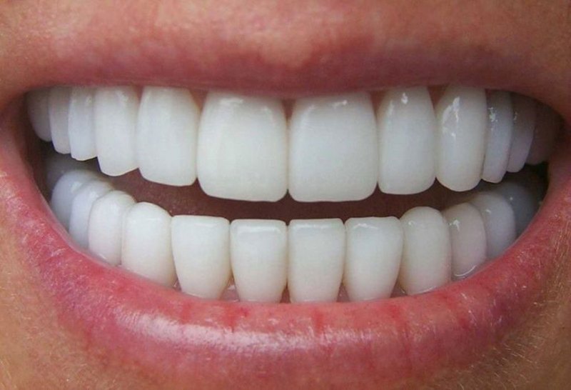 Lựa chọn địa chỉ nha khoa tin cậy để có hàm răng đẹp