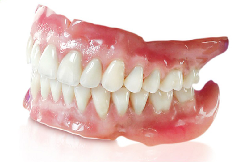 Trồng răng giả tháo lắp là phương pháp phục hình nha khoa cho răng bị mất