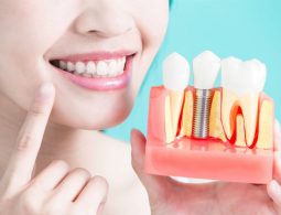 [Giải Đáp] Trồng Răng Implant Có Đau Không? Các Yếu Tố Ảnh Hưởng