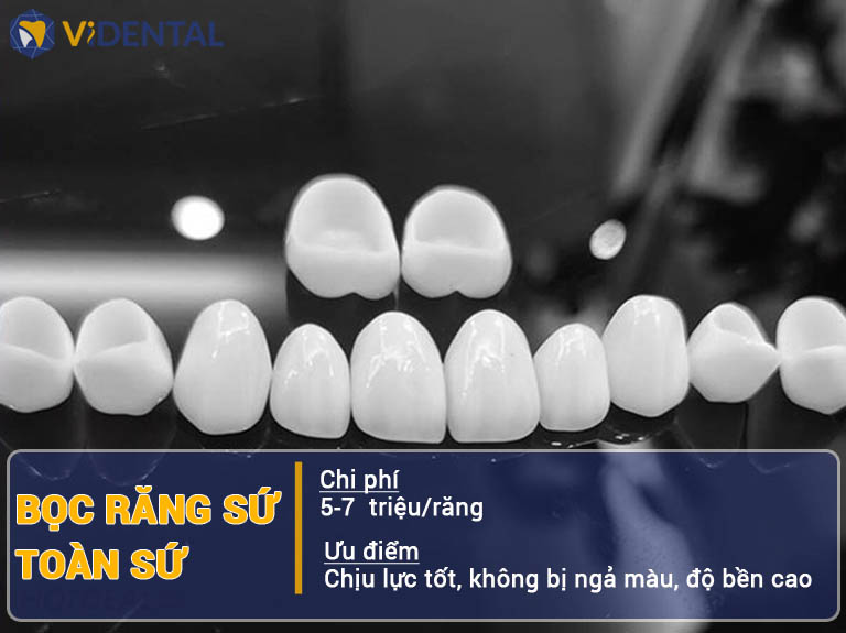 Bọc răng sứ trả góp tại Videntlal lãi suất 0%