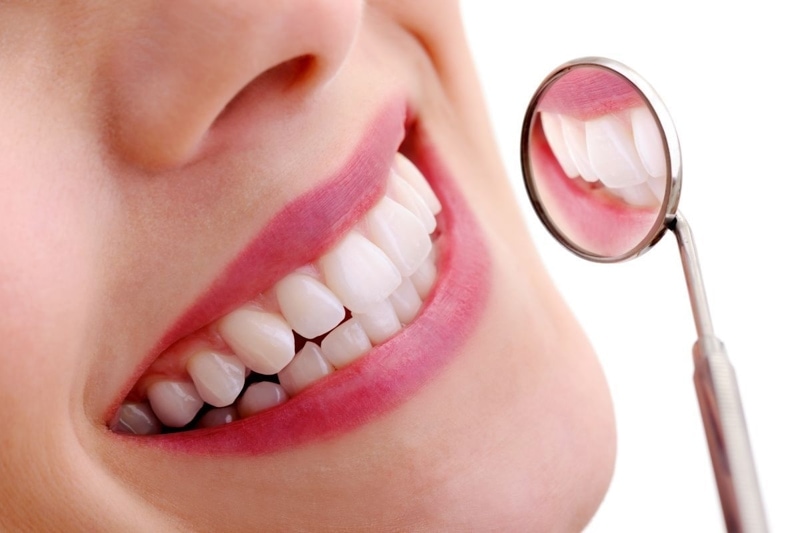 Trồng răng bắc cầu sứ áp dụng cho đối tượng có chân răng khỏe mạnh 