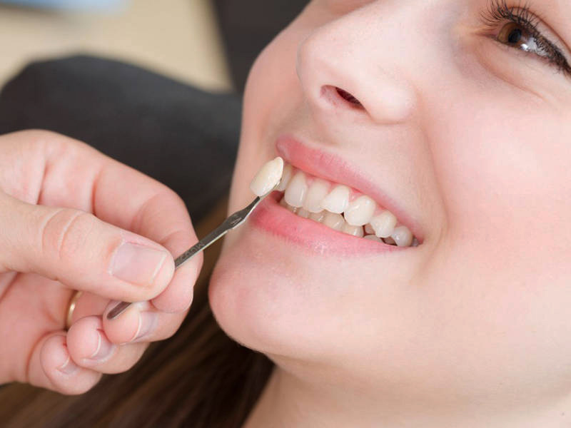 Trồng răng khểnh composite thường ít gây đau đớn