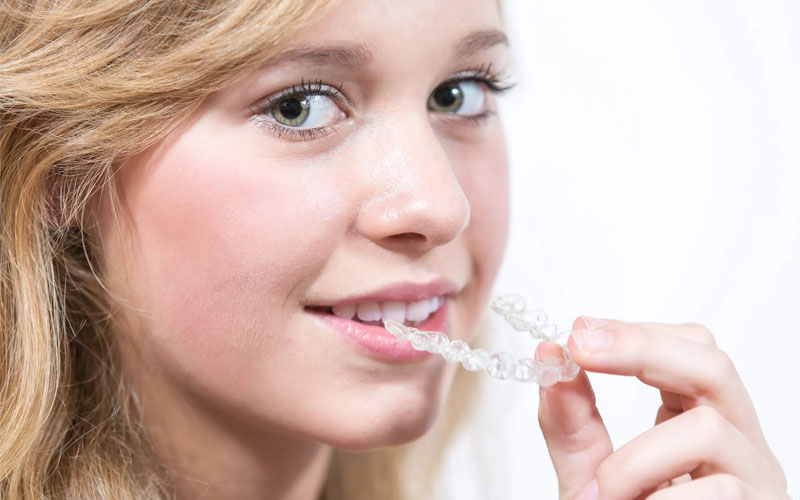 Việc niềng răng có những ưu điểm và nhược điểm nhất định