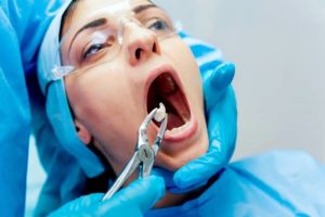 Niềng Răng Có Phải Nhổ Răng Không, Nhổ Răng Nào Và Bao Nhiêu Răng