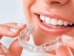 Niềng răng nhựa: Khám Các Phá Phương Pháp Hiệu Quả Và Chi Phí
