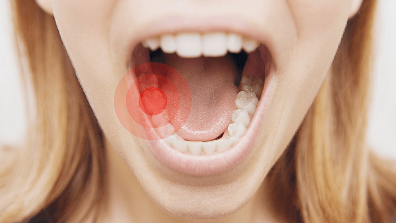 Bạn có thể bị đau răng, chảy máu chân răng vô cùng nguy hiểm nếu làm răng không đảm bảo