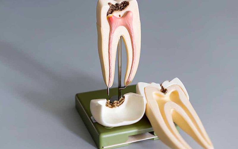 Tủy răng nằm sâu phía trong, được bảo vệ bởi các bộ phận xung quanh