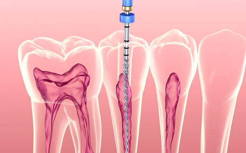 Hệ thống mạch máu của mô tủy có nhiệm vụ nuôi dưỡng ngà răng, tủy răng