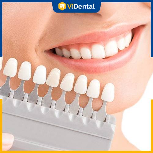 Bọc răng sứ thẩm mỹ mang đến nhiều lợi ích và những thay đổi khác biệt