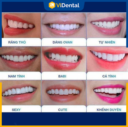 Có nhiều dáng răng cho bạn chọn lựa