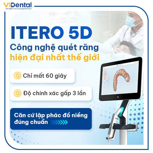 iTero 5D - Công nghệ lấy mẫu hàm chỉ với 60s