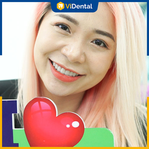 Chị Dương tự tin sau bọc răng sứ tại Trung Tâm ViDental Clinic