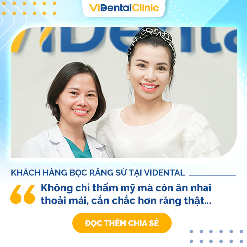 Khách hàng chia sẻ về bọc răng sứ tại Trung Tâm ViDental Clinic