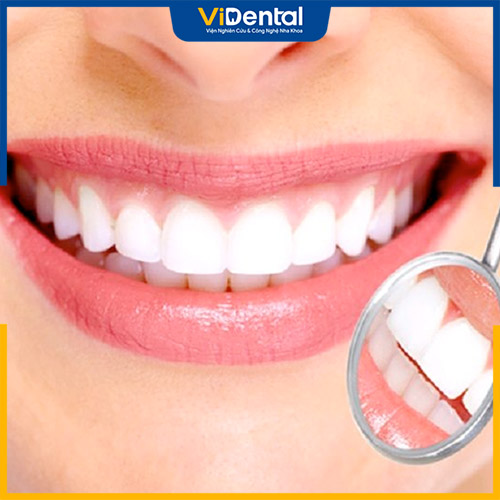 Bọc răng sứ thẩm mỹ là phương pháp giúp khắc phục khuyết điểm của răng