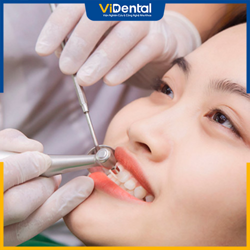 Thăm khám nha khoa tổng quát là bước đầu tiên cần thiết trước khi bọc răng sứ