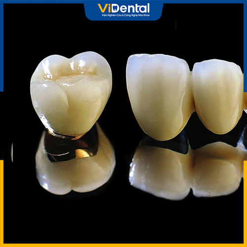 Răng sứ Titan thích hợp với những ai bị dị ứng với kim loại thông thường