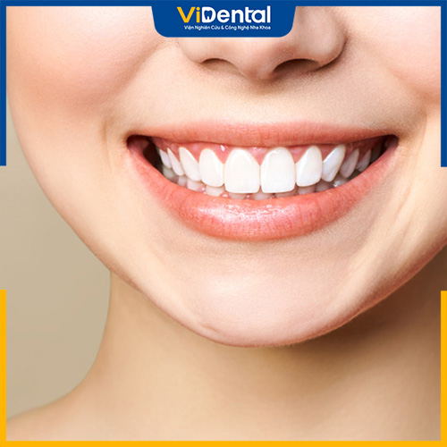 Răng sứ khung kim loại giúp khôi phục khả năng ăn nhai và tăng tính thẩm mỹ